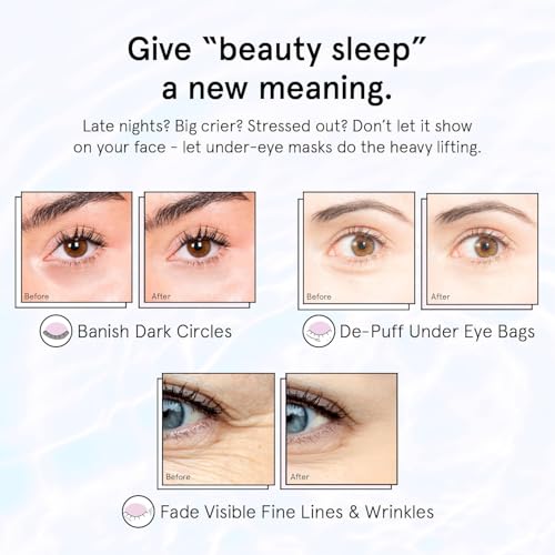 grace & stella Retinol Under Eye Patches for Puffy Eyes & Dark Circles - Restoring Gel Under Eye Masks with Hyaluronic Acid - Birthday Gifts for Women, Bachelorette Party Favors (Purple, 24 Pairs)