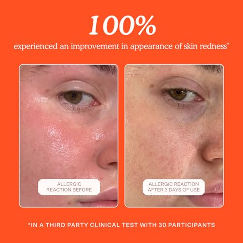 Tower 28 SOS Daily Rescue Facial Spray - Hypochlorous Acid Spray to Help Reduce Redness, Calm Irritation + Alleviate Flare-Ups - Purifying Travel Size Face Toner - Everyday Skin Care Essential (1 oz)