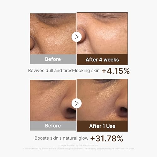 medicube Deep Vitamin C Capsule Serum | Hydrating Vitamin C Serum for Dull & Uneven-Looking Skin with Visible Concerns | Liposome Capsules for Smooth, Radiant Texture | Korean Skincare 1.01 fl.oz